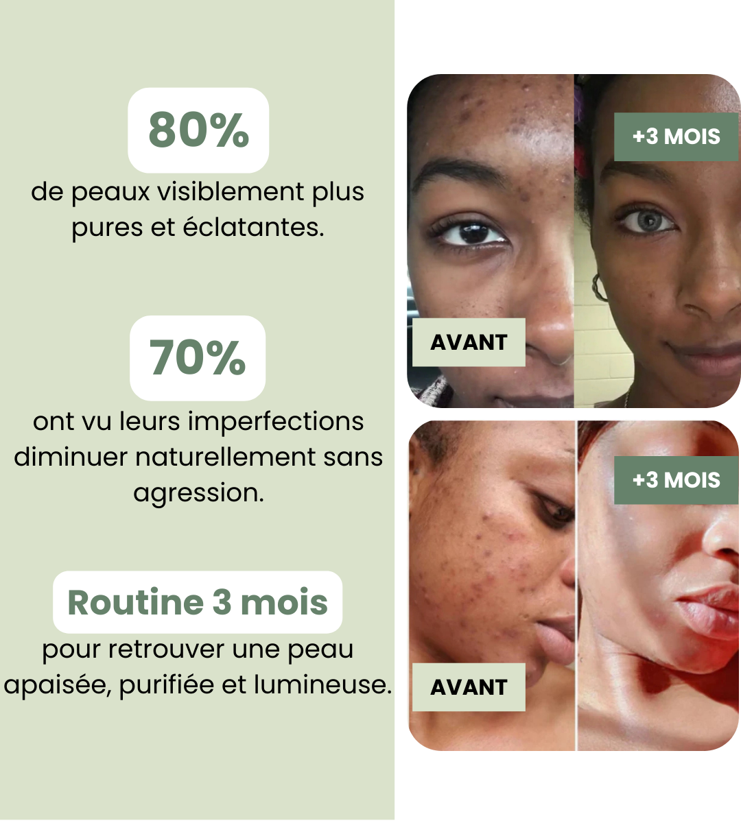 Masque Visage Purifiant à l'Argile Verte