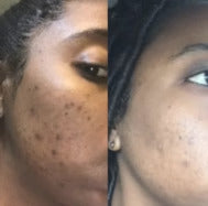 Masque Visage Purifiant à l'Argile Verte